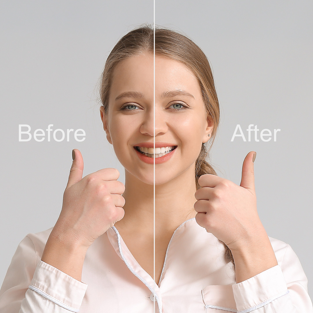 A portrait split into halves labelled Before and After, the After half showing clearer skin